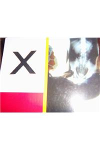 PM Collection Alphabet Starters: Alphabet Starters Letter X
