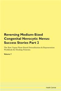 Reversing Medium-Sized Congenital Nevocy