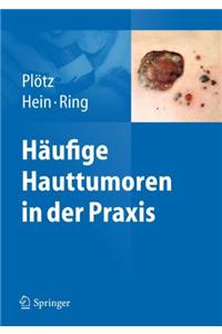 HÃ¤ufige Hauttumoren in Der Praxis