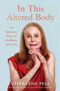 In This Altered Body