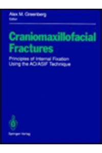 Craniomaxillofacial Fractures: Principles of Internal Fixation Using the Ao/Asif Technique