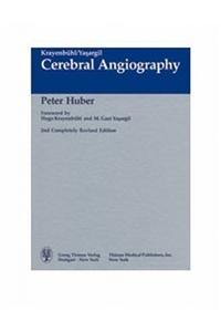 Cerebral Angiography