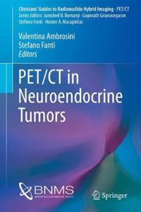 PET/CT in Neuroendocrine Tumors