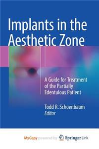 Implants in the Aesthetic Zone