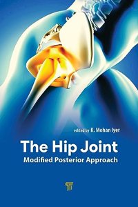 Hip Joint