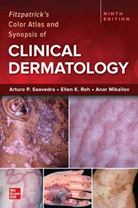 FITZPATRICKS COLOR ATLAS AND SYNOPSIS OF CLINICAL DERMATOLOGY 9ED (IE) (PB 2023)