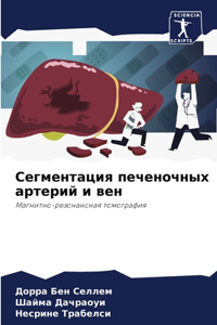 Сегментация печеночных артерий и вен