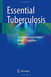 Essential Tuberculosis