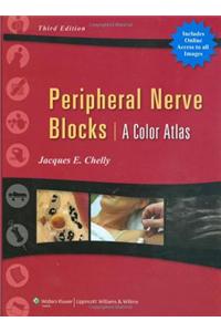 Peripheral Nerve Blocks