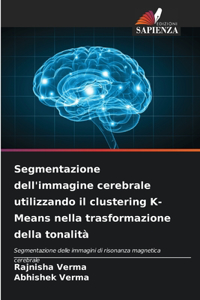 Segmentazione dell'immagine cerebrale utilizzando il clustering K-Means nella trasformazione della tonalità