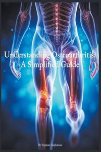 Understanding Osteoarthritis: A Simplified Guide