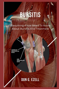 Bursitis