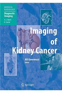 Imaging of Kidney Cancer