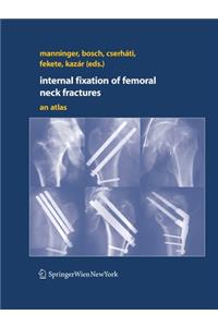 Internal Fixation of Femoral Neck Fractures