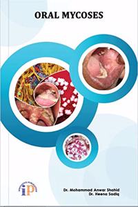 Oral Mycoses