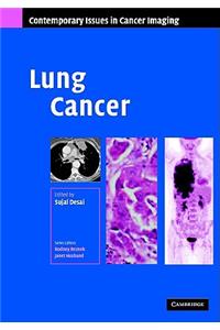 Lung Cancer