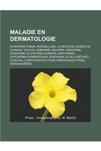 Maladie En Dermatologie: Syndrome Poems, Morgellons, Lichen Plan, Deme de Quincke, Vitiligo, Albinisme, Escarre, Gangrene, Syndrome de Stevens-