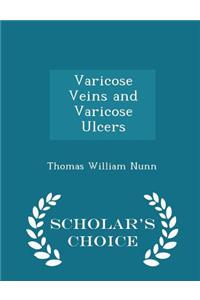 Varicose Veins and Varicose Ulcers - Scholar's Choice Edition