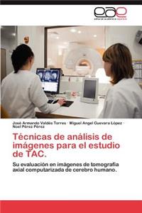 Técnicas de análisis de imágenes para el estudio de TAC.