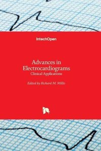 Advances in Electrocardiograms