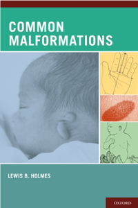 Common Malformations