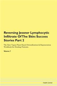 Reversing Jessner Lymphocytic Infiltrate