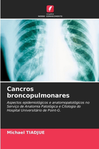 Cancros broncopulmonares