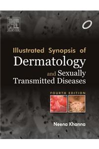 Illustrated Synopsis of Dermatology and Sexually TransmittedDiseases