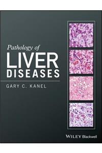 Pathology of Liver Diseases