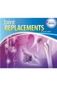 Joint Replacements