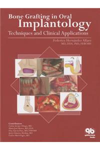 Bone Grafting in Oral Implantology
