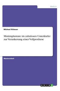 Miniimplantate im zahnlosen Unterkiefer zur Verankerung einer Vollprothese