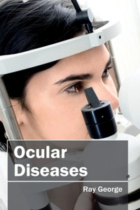 Ocular Diseases