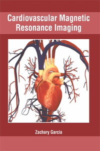 Cardiovascular Magnetic Resonance Imaging