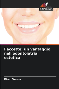 Faccette