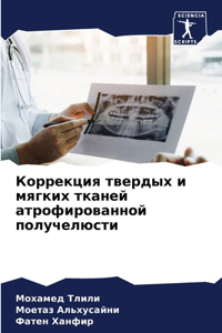 Коррекция твердых и мягких тканей атрофl