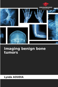 Imaging benign bone tumors