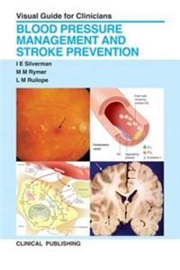 Blood Pressure Management and Stroke Prevention: Visual Guide for Clinicians