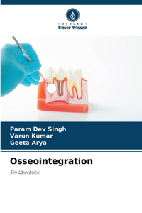 Osseointegration