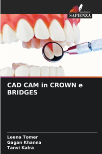 CAD CAM in CROWN e BRIDGES