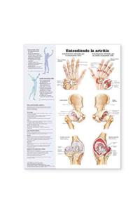 Understanding Arthritis Spanish