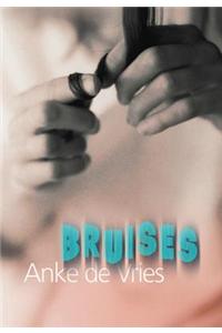 Bruises