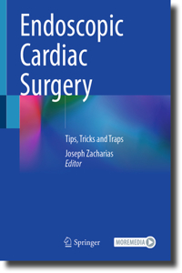 Endoscopic Cardiac Surgery