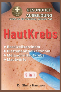 Hautkrebs: Basalzellkarzinom, Plattenepithelkarzinom, Melanom-Hautkrebs, Maulwurf: Typen, Symptome, Ursachen, Diagnose, Behandlung, Medikamente, Prävention und