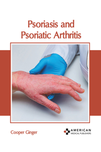 Psoriasis and Psoriatic Arthritis