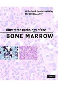 Illustrated Pathology of the Bone Marrow