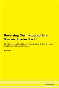 Reversing Dermatographism: Success Stori