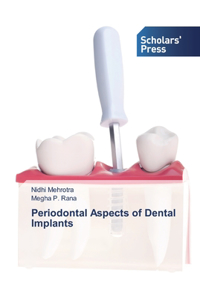Periodontal Aspects of Dental Implants