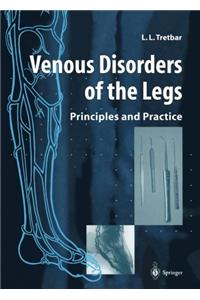 Venous Disorders of the Legs