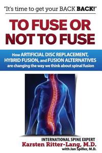To Fuse or Not to Fuse